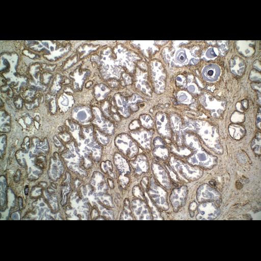  NCBI Organism:Homo sapiens; Cell Types:endocrine-paracrine cell of prostate gland, basal cell of prostate epithelium, luminal cell of prostate epithelium, blood vessel endothelial cell, perineural cell, sheath cell, leukocyte, prostate stromal cell, smooth muscle cell of prostate; Cell Components:nucleus, cell surface;