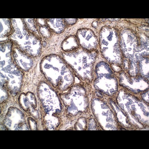  NCBI Organism:Homo sapiens; Cell Types:endocrine-paracrine cell of prostate gland, basal cell of prostate epithelium, luminal cell of prostate epithelium, blood vessel endothelial cell, perineural cell, sheath cell, leukocyte, prostate stromal cell, smooth muscle cell of prostate; Cell Components:nucleus, cell surface;