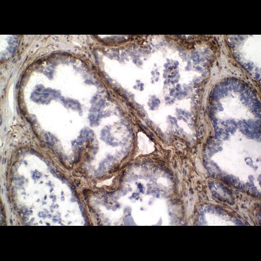  NCBI Organism:Homo sapiens; Cell Types:endocrine-paracrine cell of prostate gland, basal cell of prostate epithelium, luminal cell of prostate epithelium, blood vessel endothelial cell, perineural cell, sheath cell, leukocyte, prostate stromal cell, smooth muscle cell of prostate; Cell Components:nucleus, cell surface;