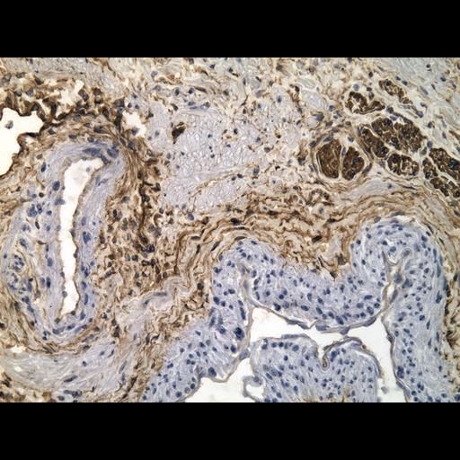  NCBI Organism:Homo sapiens; Cell Types:endocrine-paracrine cell of prostate gland, basal cell of prostate epithelium, luminal cell of prostate epithelium, blood vessel endothelial cell, perineural cell, sheath cell, leukocyte, prostate stromal cell, smooth muscle cell of prostate; Cell Components:nucleus, cell surface;