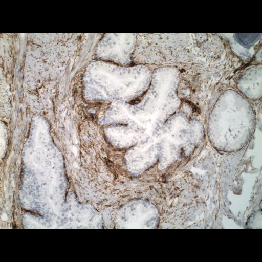  NCBI Organism:Homo sapiens; Cell Types:endocrine-paracrine cell of prostate gland, basal cell of prostate epithelium, luminal cell of prostate epithelium, blood vessel endothelial cell, perineural cell, sheath cell, leukocyte, prostate stromal cell, smooth muscle cell of prostate; Cell Components:nucleus, cell surface;