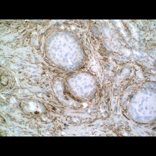  NCBI Organism:Homo sapiens; Cell Types:endocrine-paracrine cell of prostate gland, basal cell of prostate epithelium, luminal cell of prostate epithelium, blood vessel endothelial cell, perineural cell, sheath cell, leukocyte, prostate stromal cell, smooth muscle cell of prostate; Cell Components:nucleus, cell surface;