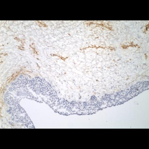  NCBI Organism:Homo sapiens; Cell Types:endocrine-paracrine cell of prostate gland, basal cell of prostate epithelium, luminal cell of prostate epithelium, blood vessel endothelial cell, perineural cell, sheath cell, leukocyte, prostate stromal cell, smooth muscle cell of prostate; Cell Components:nucleus, cell surface;