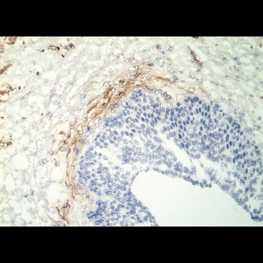  NCBI Organism:Homo sapiens; Cell Types:endocrine-paracrine cell of prostate gland, basal cell of prostate epithelium, luminal cell of prostate epithelium, blood vessel endothelial cell, perineural cell, sheath cell, leukocyte, prostate stromal cell, smooth muscle cell of prostate; Cell Components:nucleus, cell surface;