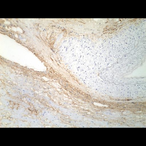  NCBI Organism:Homo sapiens; Cell Types:endocrine-paracrine cell of prostate gland, basal cell of prostate epithelium, luminal cell of prostate epithelium, blood vessel endothelial cell, perineural cell, sheath cell, leukocyte, prostate stromal cell, smooth muscle cell of prostate; Cell Components:nucleus, cell surface;