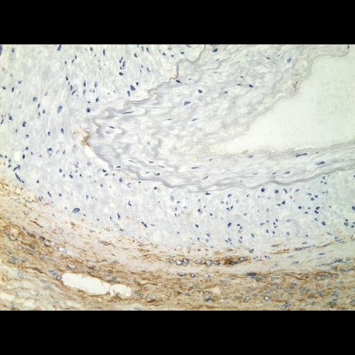  NCBI Organism:Homo sapiens; Cell Types:endocrine-paracrine cell of prostate gland, basal cell of prostate epithelium, luminal cell of prostate epithelium, blood vessel endothelial cell, perineural cell, sheath cell, leukocyte, prostate stromal cell, smooth muscle cell of prostate; Cell Components:nucleus, cell surface;