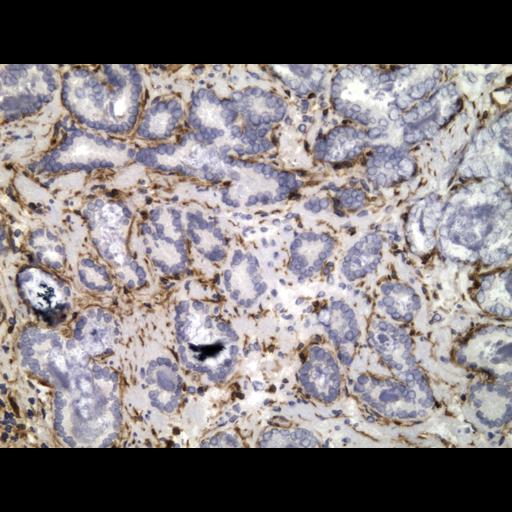  NCBI Organism:Homo sapiens; Cell Types:endocrine-paracrine cell of prostate gland, basal cell of prostate epithelium, luminal cell of prostate epithelium, blood vessel endothelial cell, perineural cell, sheath cell, leukocyte, prostate stromal cell, smooth muscle cell of prostate; Cell Components:nucleus, cell surface;