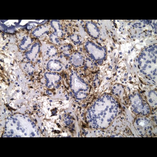  NCBI Organism:Homo sapiens; Cell Types:endocrine-paracrine cell of prostate gland, basal cell of prostate epithelium, luminal cell of prostate epithelium, blood vessel endothelial cell, perineural cell, sheath cell, leukocyte, prostate stromal cell, smooth muscle cell of prostate; Cell Components:nucleus, cell surface;