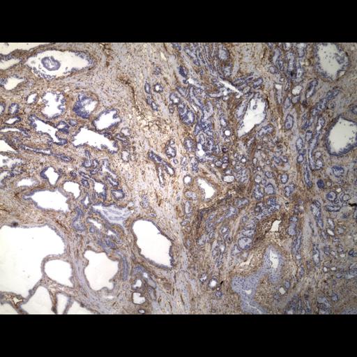  NCBI Organism:Homo sapiens; Cell Types:endocrine-paracrine cell of prostate gland, basal cell of prostate epithelium, luminal cell of prostate epithelium, blood vessel endothelial cell, perineural cell, sheath cell, leukocyte, prostate stromal cell, smooth muscle cell of prostate; Cell Components:nucleus, cell surface;