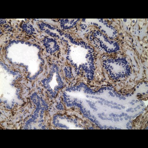  NCBI Organism:Homo sapiens; Cell Types:endocrine-paracrine cell of prostate gland, basal cell of prostate epithelium, luminal cell of prostate epithelium, blood vessel endothelial cell, perineural cell, sheath cell, leukocyte, prostate stromal cell, smooth muscle cell of prostate; Cell Components:nucleus, cell surface;