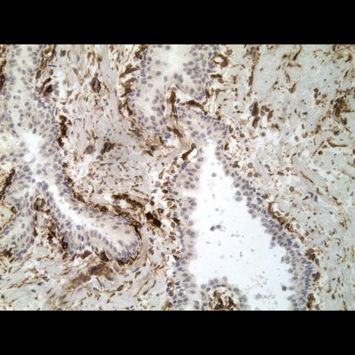  NCBI Organism:Homo sapiens; Cell Types:endocrine-paracrine cell of prostate gland, basal cell of prostate epithelium, luminal cell of prostate epithelium, blood vessel endothelial cell, perineural cell, sheath cell, leukocyte, prostate stromal cell, smooth muscle cell of prostate; Cell Components:nucleus, cell surface;