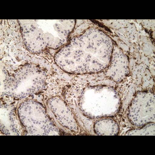  NCBI Organism:Homo sapiens; Cell Types:endocrine-paracrine cell of prostate gland, basal cell of prostate epithelium, luminal cell of prostate epithelium, blood vessel endothelial cell, perineural cell, sheath cell, leukocyte, prostate stromal cell, smooth muscle cell of prostate; Cell Components:nucleus, cell surface;