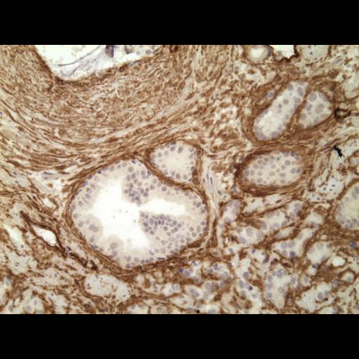  NCBI Organism:Homo sapiens; Cell Types:endocrine-paracrine cell of prostate gland, basal cell of prostate epithelium, luminal cell of prostate epithelium, blood vessel endothelial cell, perineural cell, sheath cell, leukocyte, prostate stromal cell, smooth muscle cell of prostate; Cell Components:nucleus, cell surface;