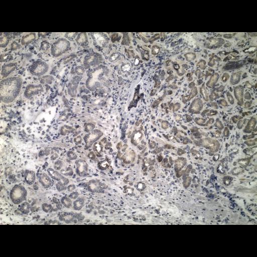  NCBI Organism:Homo sapiens; Cell Types:endocrine-paracrine cell of prostate gland, basal cell of prostate epithelium, luminal cell of prostate epithelium, blood vessel endothelial cell, perineural cell, sheath cell, leukocyte, prostate stromal cell, smooth muscle cell of prostate; Cell Components:nucleus, cell surface;