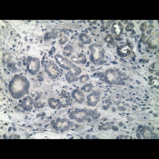  NCBI Organism:Homo sapiens; Cell Types:endocrine-paracrine cell of prostate gland, basal cell of prostate epithelium, luminal cell of prostate epithelium, blood vessel endothelial cell, perineural cell, sheath cell, leukocyte, prostate stromal cell, smooth muscle cell of prostate; Cell Components:nucleus, cell surface;