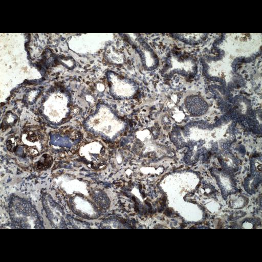  NCBI Organism:Homo sapiens; Cell Types:endocrine-paracrine cell of prostate gland, basal cell of prostate epithelium, luminal cell of prostate epithelium, blood vessel endothelial cell, perineural cell, sheath cell, leukocyte, prostate stromal cell, smooth muscle cell of prostate; Cell Components:nucleus, cell surface;