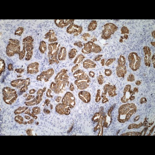  NCBI Organism:Homo sapiens; Cell Types:endocrine-paracrine cell of prostate gland, basal cell of prostate epithelium, luminal cell of prostate epithelium, blood vessel endothelial cell, perineural cell, sheath cell, leukocyte, prostate stromal cell, smooth muscle cell of prostate; Cell Components:nucleus, cell surface;