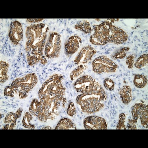  NCBI Organism:Homo sapiens; Cell Types:endocrine-paracrine cell of prostate gland, basal cell of prostate epithelium, luminal cell of prostate epithelium, blood vessel endothelial cell, perineural cell, sheath cell, leukocyte, prostate stromal cell, smooth muscle cell of prostate; Cell Components:nucleus, cell surface;