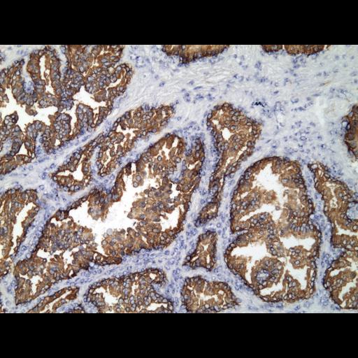  NCBI Organism:Homo sapiens; Cell Types:endocrine-paracrine cell of prostate gland, basal cell of prostate epithelium, luminal cell of prostate epithelium, blood vessel endothelial cell, perineural cell, sheath cell, leukocyte, prostate stromal cell, smooth muscle cell of prostate; Cell Components:nucleus, cell surface;