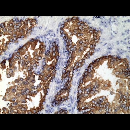  NCBI Organism:Homo sapiens; Cell Types:endocrine-paracrine cell of prostate gland, basal cell of prostate epithelium, luminal cell of prostate epithelium, blood vessel endothelial cell, perineural cell, sheath cell, leukocyte, prostate stromal cell, smooth muscle cell of prostate; Cell Components:nucleus, cell surface;