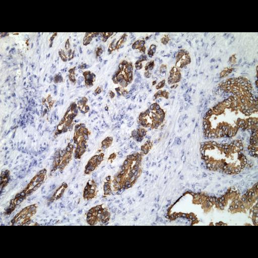  NCBI Organism:Homo sapiens; Cell Types:endocrine-paracrine cell of prostate gland, basal cell of prostate epithelium, luminal cell of prostate epithelium, blood vessel endothelial cell, perineural cell, sheath cell, leukocyte, prostate stromal cell, smooth muscle cell of prostate; Cell Components:nucleus, cell surface;