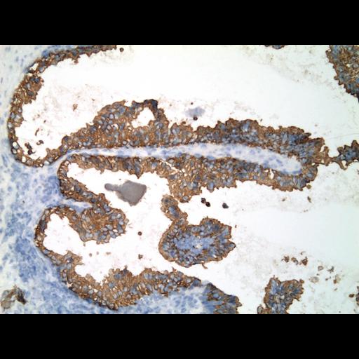  NCBI Organism:Homo sapiens; Cell Types:endocrine-paracrine cell of prostate gland, basal cell of prostate epithelium, luminal cell of prostate epithelium, blood vessel endothelial cell, perineural cell, sheath cell, leukocyte, prostate stromal cell, smooth muscle cell of prostate; Cell Components:nucleus, cell surface;