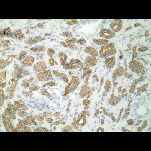  NCBI Organism:Homo sapiens; Cell Types:endocrine-paracrine cell of prostate gland, basal cell of prostate epithelium, luminal cell of prostate epithelium, blood vessel endothelial cell, perineural cell, sheath cell, leukocyte, prostate stromal cell, smooth muscle cell of prostate; Cell Components:nucleus, cell surface;