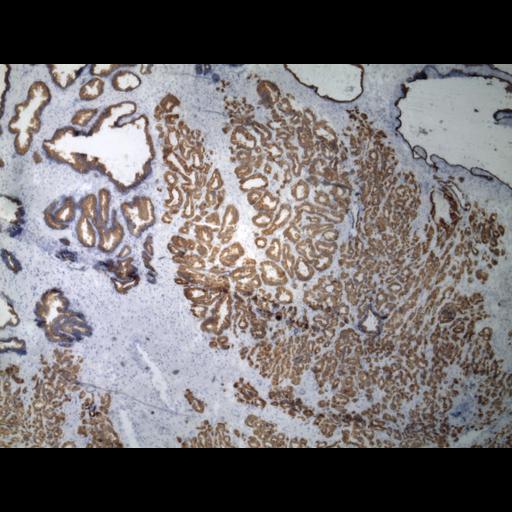  NCBI Organism:Homo sapiens; Cell Types:endocrine-paracrine cell of prostate gland, basal cell of prostate epithelium, luminal cell of prostate epithelium, blood vessel endothelial cell, perineural cell, sheath cell, leukocyte, prostate stromal cell, smooth muscle cell of prostate; Cell Components:nucleus, cell surface;