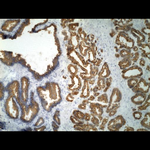  NCBI Organism:Homo sapiens; Cell Types:endocrine-paracrine cell of prostate gland, basal cell of prostate epithelium, luminal cell of prostate epithelium, blood vessel endothelial cell, perineural cell, sheath cell, leukocyte, prostate stromal cell, smooth muscle cell of prostate; Cell Components:nucleus, cell surface;