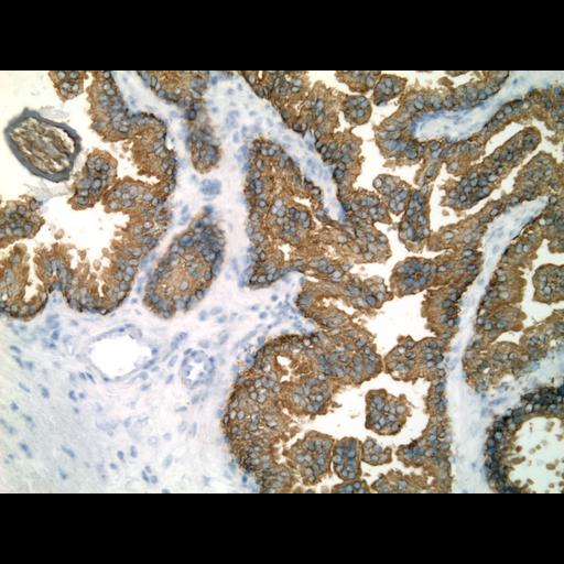  NCBI Organism:Homo sapiens; Cell Types:endocrine-paracrine cell of prostate gland, basal cell of prostate epithelium, luminal cell of prostate epithelium, blood vessel endothelial cell, perineural cell, sheath cell, leukocyte, prostate stromal cell, smooth muscle cell of prostate; Cell Components:nucleus, cell surface;