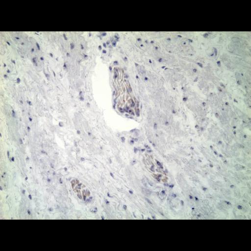  NCBI Organism:Homo sapiens; Cell Types:endocrine-paracrine cell of prostate gland, basal cell of prostate epithelium, luminal cell of prostate epithelium, blood vessel endothelial cell, perineural cell, sheath cell, leukocyte, prostate stromal cell, smooth muscle cell of prostate; Cell Components:nucleus, cell surface;