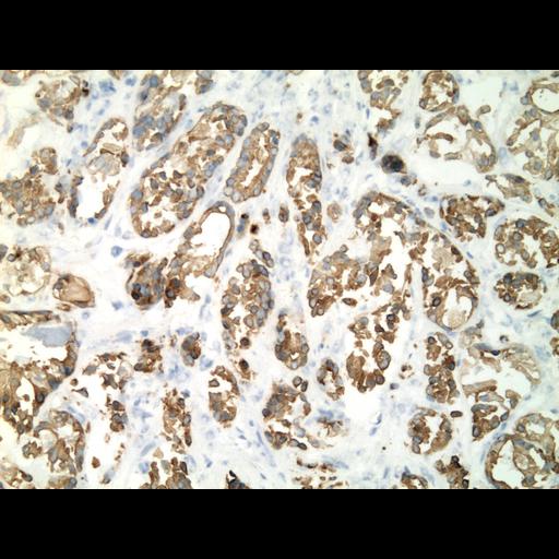  NCBI Organism:Homo sapiens; Cell Types:endocrine-paracrine cell of prostate gland, basal cell of prostate epithelium, luminal cell of prostate epithelium, blood vessel endothelial cell, perineural cell, sheath cell, leukocyte, prostate stromal cell, smooth muscle cell of prostate; Cell Components:nucleus, cell surface;