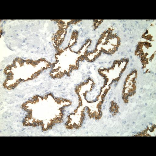  NCBI Organism:Homo sapiens; Cell Types:endocrine-paracrine cell of prostate gland, basal cell of prostate epithelium, luminal cell of prostate epithelium, blood vessel endothelial cell, perineural cell, sheath cell, leukocyte, prostate stromal cell, smooth muscle cell of prostate; Cell Components:nucleus, cell surface;