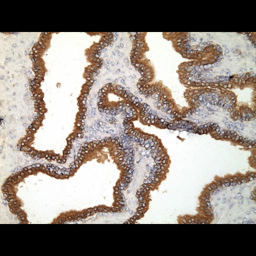  NCBI Organism:Homo sapiens; Cell Types:endocrine-paracrine cell of prostate gland, basal cell of prostate epithelium, luminal cell of prostate epithelium, blood vessel endothelial cell, perineural cell, sheath cell, leukocyte, prostate stromal cell, smooth muscle cell of prostate; Cell Components:nucleus, cell surface;