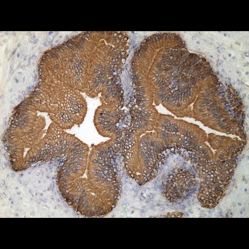  NCBI Organism:Homo sapiens; Cell Types:endocrine-paracrine cell of prostate gland, basal cell of prostate epithelium, luminal cell of prostate epithelium, blood vessel endothelial cell, perineural cell, sheath cell, leukocyte, prostate stromal cell, smooth muscle cell of prostate; Cell Components:nucleus, cell surface;