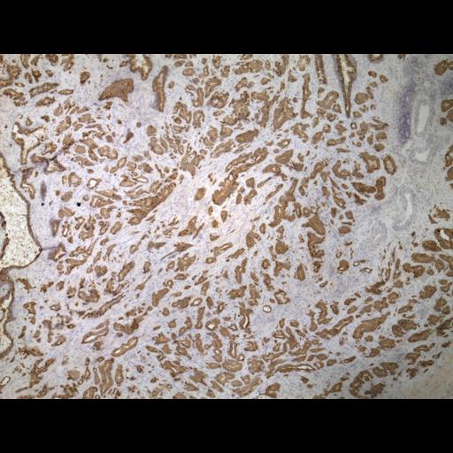  NCBI Organism:Homo sapiens; Cell Types:endocrine-paracrine cell of prostate gland, basal cell of prostate epithelium, luminal cell of prostate epithelium, blood vessel endothelial cell, perineural cell, sheath cell, leukocyte, prostate stromal cell, smooth muscle cell of prostate; Cell Components:nucleus, cell surface;