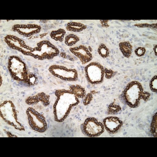  NCBI Organism:Homo sapiens; Cell Types:endocrine-paracrine cell of prostate gland, basal cell of prostate epithelium, luminal cell of prostate epithelium, blood vessel endothelial cell, perineural cell, sheath cell, leukocyte, prostate stromal cell, smooth muscle cell of prostate; Cell Components:nucleus, cell surface;