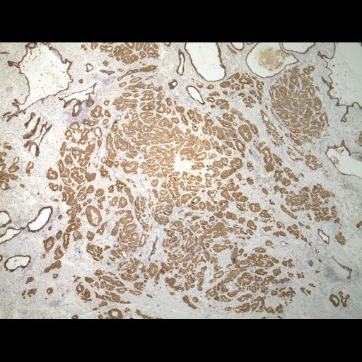  NCBI Organism:Homo sapiens; Cell Types:endocrine-paracrine cell of prostate gland, basal cell of prostate epithelium, luminal cell of prostate epithelium, blood vessel endothelial cell, perineural cell, sheath cell, leukocyte, prostate stromal cell, smooth muscle cell of prostate; Cell Components:nucleus, cell surface;