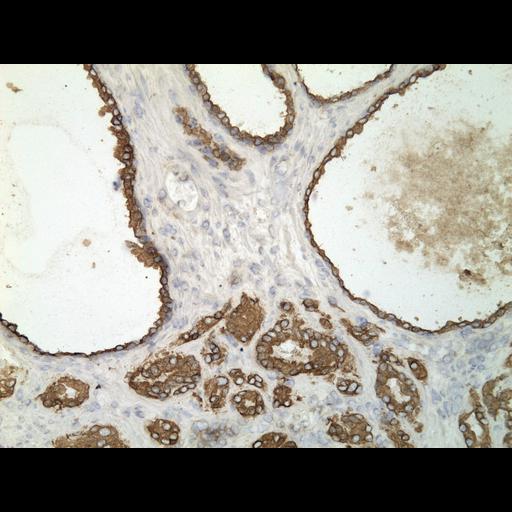  NCBI Organism:Homo sapiens; Cell Types:endocrine-paracrine cell of prostate gland, basal cell of prostate epithelium, luminal cell of prostate epithelium, blood vessel endothelial cell, perineural cell, sheath cell, leukocyte, prostate stromal cell, smooth muscle cell of prostate; Cell Components:nucleus, cell surface;