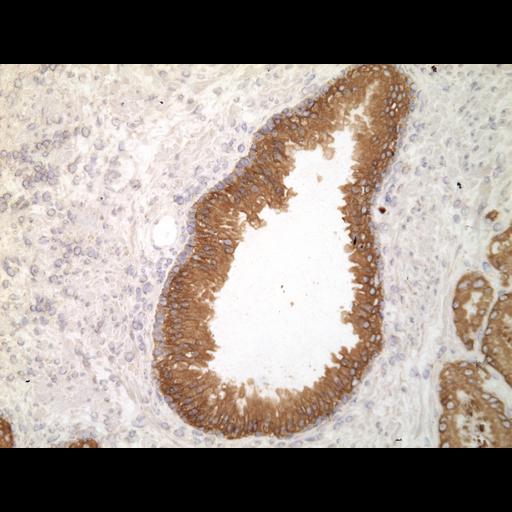  NCBI Organism:Homo sapiens; Cell Types:endocrine-paracrine cell of prostate gland, basal cell of prostate epithelium, luminal cell of prostate epithelium, blood vessel endothelial cell, perineural cell, sheath cell, leukocyte, prostate stromal cell, smooth muscle cell of prostate; Cell Components:nucleus, cell surface;