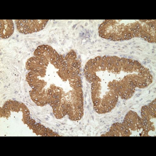  NCBI Organism:Homo sapiens; Cell Types:endocrine-paracrine cell of prostate gland, basal cell of prostate epithelium, luminal cell of prostate epithelium, blood vessel endothelial cell, perineural cell, sheath cell, leukocyte, prostate stromal cell, smooth muscle cell of prostate; Cell Components:nucleus, cell surface;