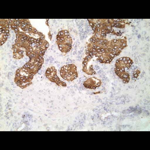  NCBI Organism:Homo sapiens; Cell Types:endocrine-paracrine cell of prostate gland, basal cell of prostate epithelium, luminal cell of prostate epithelium, blood vessel endothelial cell, perineural cell, sheath cell, leukocyte, prostate stromal cell, smooth muscle cell of prostate; Cell Components:nucleus, cell surface;