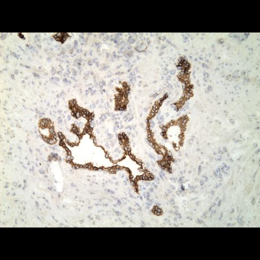  NCBI Organism:Homo sapiens; Cell Types:endocrine-paracrine cell of prostate gland, basal cell of prostate epithelium, luminal cell of prostate epithelium, blood vessel endothelial cell, perineural cell, sheath cell, leukocyte, prostate stromal cell, smooth muscle cell of prostate; Cell Components:nucleus, cell surface;