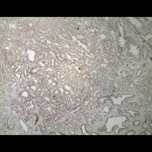  NCBI Organism:Homo sapiens; Cell Types:endocrine-paracrine cell of prostate gland, basal cell of prostate epithelium, luminal cell of prostate epithelium, blood vessel endothelial cell, perineural cell, sheath cell, leukocyte, prostate stromal cell, smooth muscle cell of prostate; Cell Components:nucleus, cell surface;