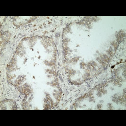  NCBI Organism:Homo sapiens; Cell Types:endocrine-paracrine cell of prostate gland, basal cell of prostate epithelium, luminal cell of prostate epithelium, blood vessel endothelial cell, perineural cell, sheath cell, leukocyte, prostate stromal cell, smooth muscle cell of prostate; Cell Components:nucleus, cell surface;