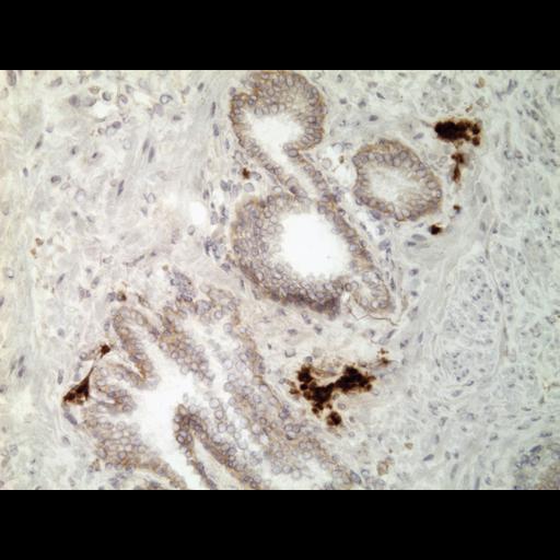  NCBI Organism:Homo sapiens; Cell Types:endocrine-paracrine cell of prostate gland, basal cell of prostate epithelium, luminal cell of prostate epithelium, blood vessel endothelial cell, perineural cell, sheath cell, leukocyte, prostate stromal cell, smooth muscle cell of prostate; Cell Components:nucleus, cell surface;