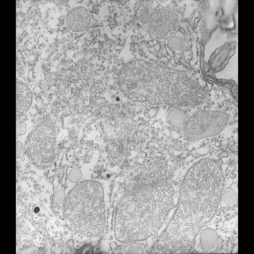  NCBI Organism:Tetrahymena pyriformis; Cell Types:cell by organism, eukaryotic cell, , ; Cell Components:cytoplasm, mitochondrion, mitochondrial inner membrane, peroxisome, rough endoplasmic reticulum, polysome; Biological process:cytoplasm organization