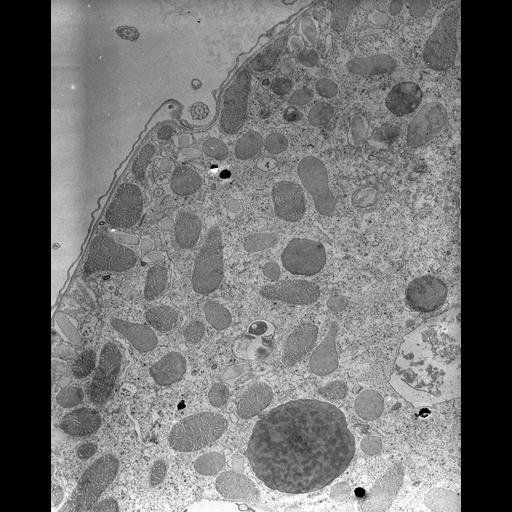  NCBI Organism:Tetrahymena pyriformis; Cell Types:cell by organism, eukaryotic cell, , ; Cell Components:micronucleus, cytoplasm, autophagic vacuole; Biological process:micronucleus organization, autophagy;