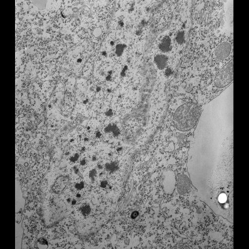  NCBI Organism:Tetrahymena pyriformis; Cell Types:cell by organism, eukaryotic cell, , ; Cell Components:macronucleus, nuclear pore, nuclear membrane; Biological process:macronucleus organization, macronucleus organization, nuclear membrane organization;