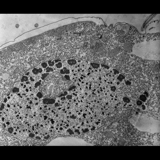  NCBI Organism:Tetrahymena pyriformis; Cell Types:cell by organism, eukaryotic cell, , ; Cell Components:macronucleus, nucleolus, nucleolus organizer region; Biological process:macronucleus organization, nucleolus organization;